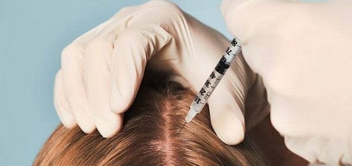 Плазматерапия волос в салоне «D'Askar cosmetology clinic» в Киеве. Записаться по скидке