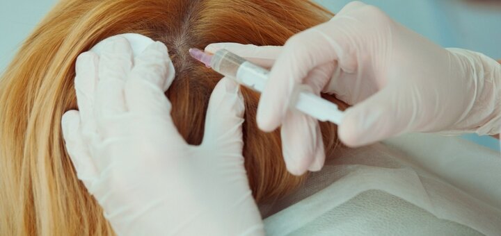 Мезотерапия волос в салоне «D'Askar cosmetology clinic» в Киеве. Записаться по скидке