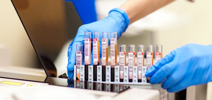 Акция в лаборатории «Invitro»