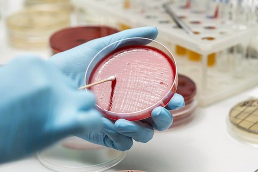 Лаборатория «Invitro». Скидки на анализы
