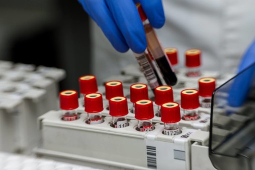 Лаборатория «Invitro». Скидки на анализы