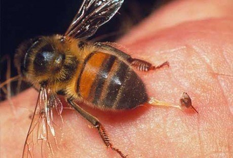Лікування бджолами «Happy Bee» у Києві. Записуйтесь по акції.