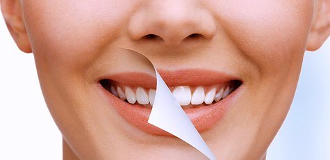 Профессиональная чистка зубов в «Denta.ua»!