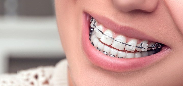 https://cdn1.pokupon.ua/uploaded/new_campaign_pictures/197937/data/main720x340/1.jpg?1476869688