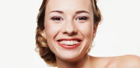Установка брекет-системы в «Andreeva PearlSmile»