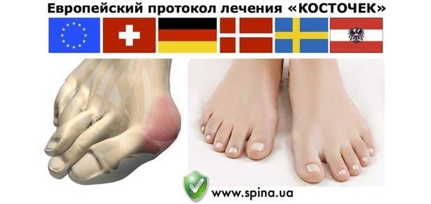 https://cdn1.pokupon.ua/uploaded/new_campaign_pictures/25366/data/main620x292/kostochki-large.jpg?1395998610