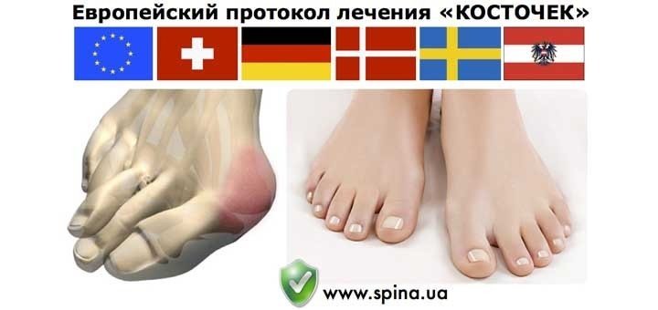 https://cdn1.pokupon.ua/uploaded/new_campaign_pictures/25366/data/main720x340/kostochki-large.jpg?1395998610