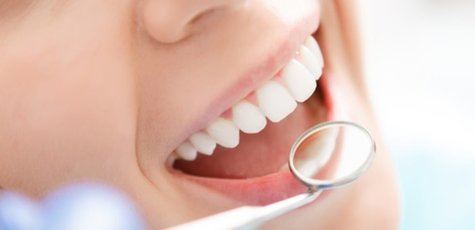 Отбеливание зубов в стоматологии «White Smile»