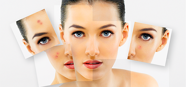 https://cdn1.pokupon.ua/uploaded/new_campaign_pictures/45167/data/main720x340/facecare-large01.jpg.png?1433948551
