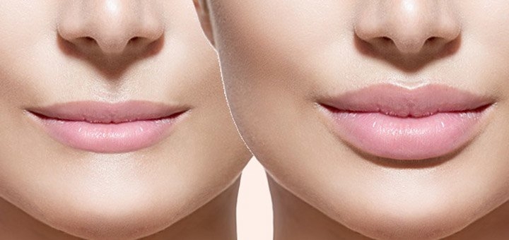 https://cdn1.pokupon.ua/uploaded/new_campaign_pictures/455958/data/main720x340/%D0%B3%D1%83%D1%87%D0%B1%D1%8B.jpg?1591341643