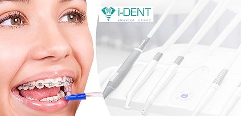 Скидка до 53% на установку брекетов в «i-DENT»