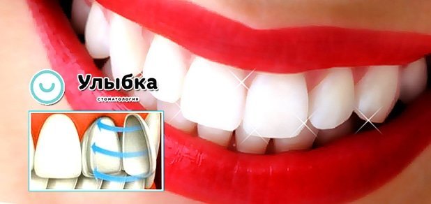 https://cdn1.pokupon.ua/uploaded/new_campaign_pictures/49284/data/main620x292/zu-3.jpg?1442474629