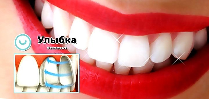 https://cdn1.pokupon.ua/uploaded/new_campaign_pictures/49284/data/main720x340/zu-3.jpg?1442474629