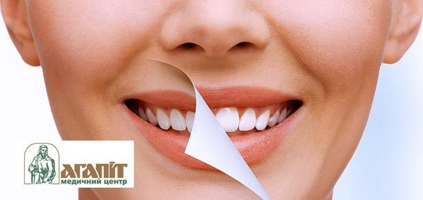 https://cdn1.pokupon.ua/uploaded/new_campaign_pictures/49882/data/main620x292/cnjvfnjkju-7889.jpg?1443601365