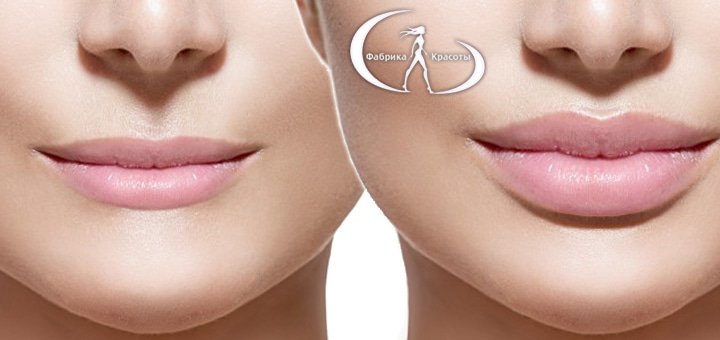 https://cdn1.pokupon.ua/uploaded/new_campaign_pictures/50308/data/main720x340/%D0%91%D0%B5%D0%B7%D0%B8%D0%BC%D0%B5%D0%BD%D0%B8-1.jpg?1444372429