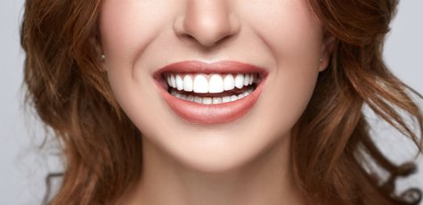 Отбеливание, чистка и Air Flow в «Rocketsmile»