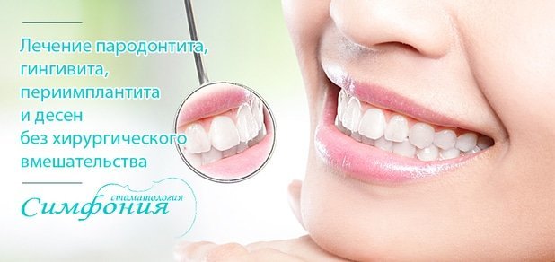 https://cdn1.pokupon.ua/uploaded/new_campaign_pictures/51415/data/main620x292/zubi-1.jpg?1446626664