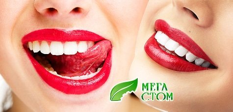 УЗ-чистка зубов, фторирование, шлифовка -83%