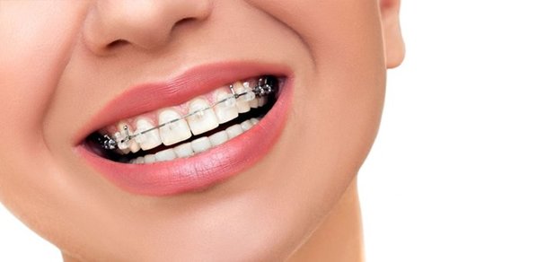 https://cdn1.pokupon.ua/uploaded/new_campaign_pictures/530626/data/main620x292/b0df22c9de60db52c3b876d88ac624f0.jpeg?1543325514