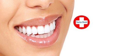 УЗ-чистка зубов + Air-Flow в «Swiss Dent» -80%
