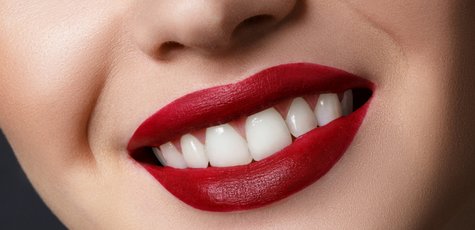 Лечение кариеса и пломбирование в «White Smile»