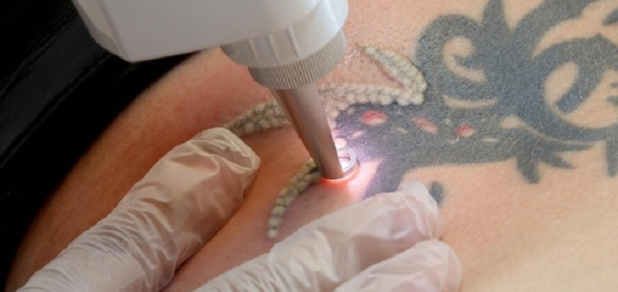 https://cdn1.pokupon.ua/uploaded/new_campaign_pictures/540918/data/main620x292/in-den-haenden-eines-arztes-oder-eines-spezialisten-koennen-sie-sich-ihr-tattoo-weglasern-lassen-_cut-photo.ru.jpg?1545133317