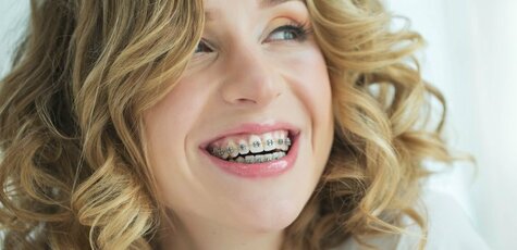 Скидка до 63% на установку брекетов в Veda Dental