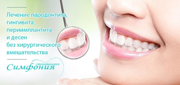 https://cdn1.pokupon.ua/uploaded/new_campaign_pictures/54378/data/main620x292/zubi-1.jpg?1450955595