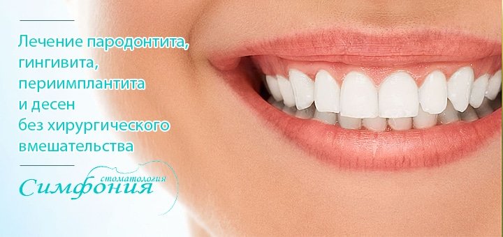 https://cdn1.pokupon.ua/uploaded/new_campaign_pictures/54379/data/main720x340/zubi-2.jpg?1450955598