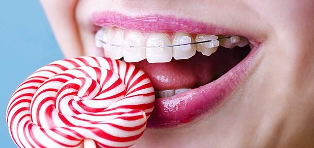 https://cdn1.pokupon.ua/uploaded/new_campaign_pictures/554097/data/main620x292/Estos-son-los-alimentos-que-debes-evitar-si-tienes-brackets..jpg?1548755005