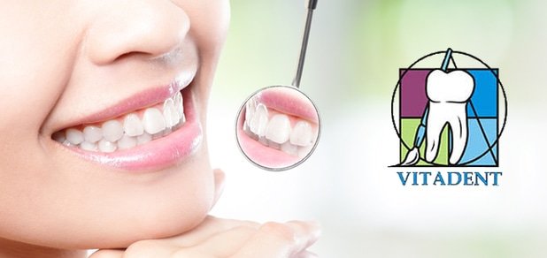 https://cdn1.pokupon.ua/uploaded/new_campaign_pictures/58314/data/main620x292/Shutterstock-Teeth-Mirror.jpg?1456154456
