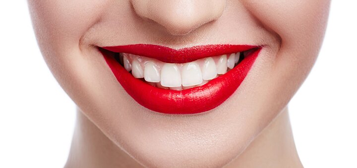 

Установка брекет-системы в клинике «Viсtoria-Dent»