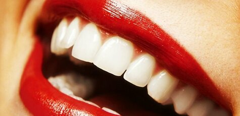 Отбеливание зубов «Magic Smile»