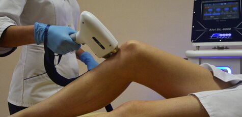 Лазерная эпиляция голеней и коленей в «LaserBar»