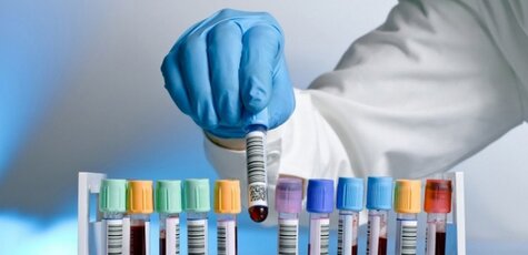Ургентні дослідження від центру «МеДіС»