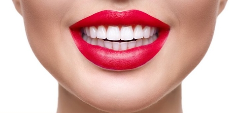 Discount on laser teeth whitening