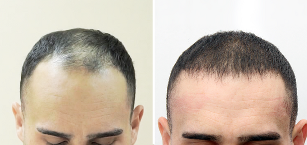 https://cdn1.pokupon.ua/uploaded/new_campaign_pictures/708093/data/main620x292/444.png?1595236927