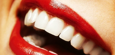 Скидка 48% на отбеливание зубов «Magic Smile»