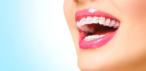 Знижка до 64% на брекети в «orthodontic studio»