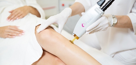 Up to 5 sessions of laser hair removal at "Vona Beauty"