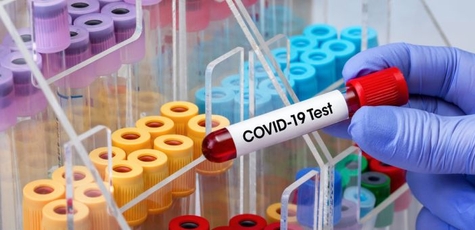 Визначення РНК вірусу (COVID-19) в «MedHouse»