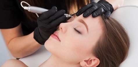 Up to 70% discount on laser tattoo removal