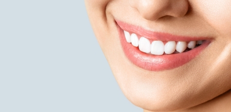 Installation of ceramic veneers in «Dental Guru»