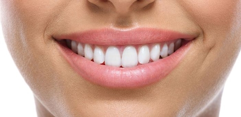 Discount on teeth whitening at «Iris»