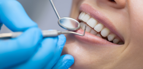 УЗ-чистка зубов с Air-Flow от «UA dentists»
