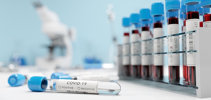 

Тест на коронавирус (COVID-19) в Biolab Diagnostic