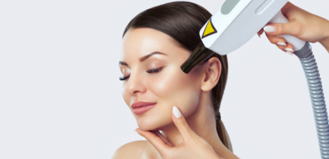 Up to 3 sessions of carbon peeling