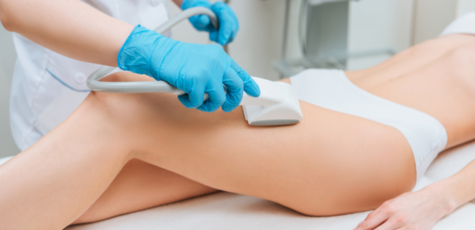 Up to 5 sessions of vacuum roller body massage