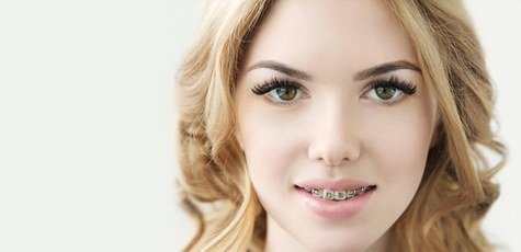 Скидка до 49% на установку брекет-систем