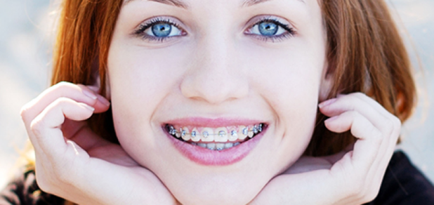 https://cdn1.pokupon.ua/uploaded/new_campaign_pictures/79402/data/main620x292/braces-720x340.png?1470304863
